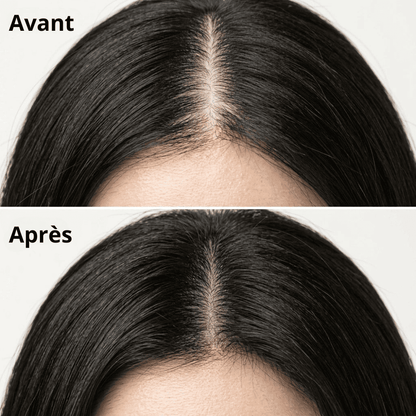 The Soracare™ Shampoing coréen solide revitalisant